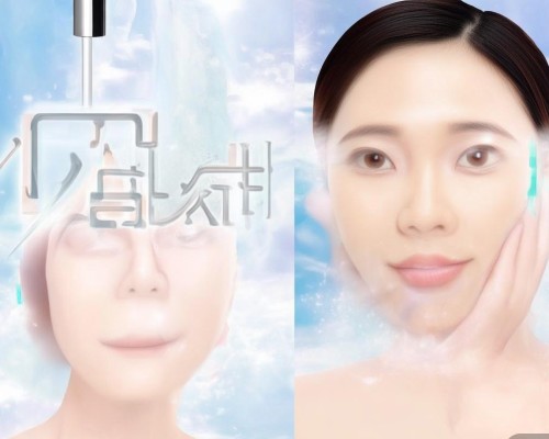 筋膜提升术，重塑面部轮廓的神奇之旅