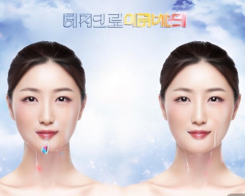 筋膜提升术，重塑面部轮廓的神奇之旅